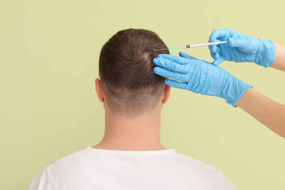 Hair Transplant Department Image